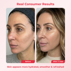 PDRN Deep Mask (4 Masks).