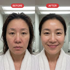 PDRN Deep Mask (4 Masks).